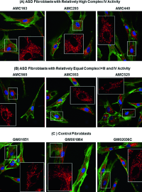 Mitochondrial Dysfunction